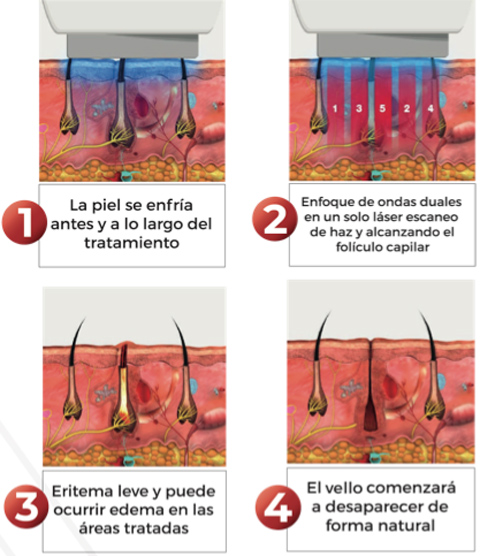 como funciona velux