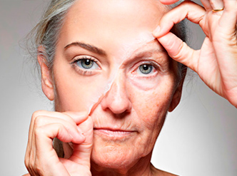 corrective peel