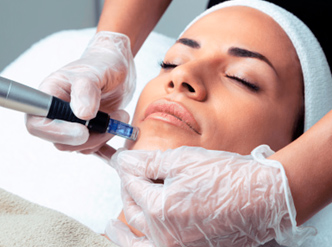 dermapen