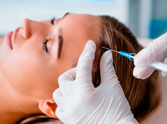 mesoterapia capilar